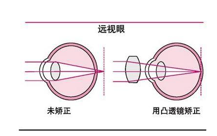 远视验光配镜原则